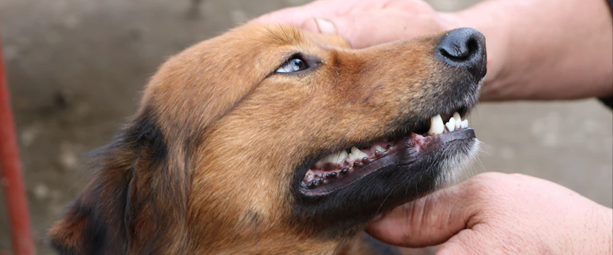 TEETH & GUMS